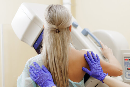 Woman wearing medical gown during mammogram procedure in clinic. Center of Radiology mammography screening for breast cancer prevention