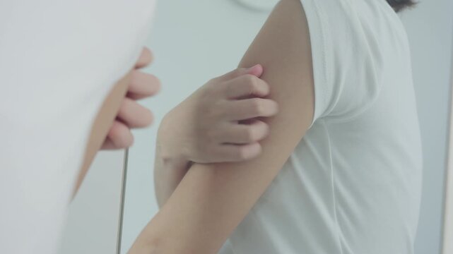 skin problem and beauty. woman scratch body has itchy skin from skin allergic, steroid allergy, sensitive skin, red from sunburn, chemical allergy, rash, insect bites, Seborrheic Dermatitis.