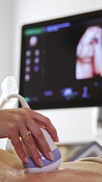Close-up of doctor performing ultrasound scan showing 3D fetal image on screen.