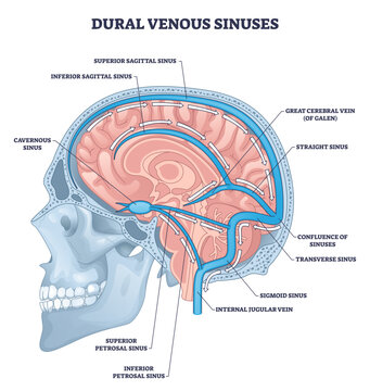 Dural venous sinuses overview illustrates brain cross section with superior sagittal sinus, transverse sinus, and internal jugular vein flow pathways, transparent background