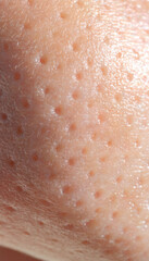 Fototapeta premium Macro skin texture pore human skin closeup rough imperfection dermis surface organic detail