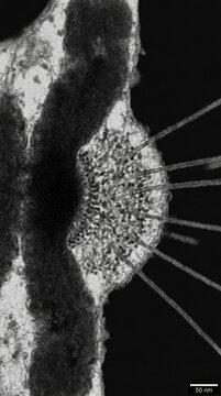 Kinetochore microtubule attachment site during eukaryotic cell division, electron micrograph showing mitotic spindle fiber, chromosome centromere region, nanometer scale macromolecular assembly.