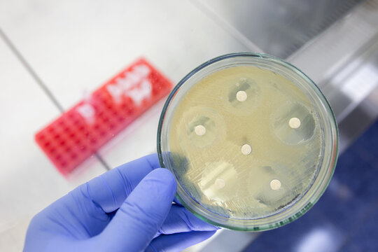 Petri dish with antibiotic discs and zones showing no bacterial growth. Testing the effect of antibiotics on bacterial strains.