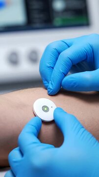 Close-Up View Of A Biosensor Device On Patient's Arm With Medical Monitor In Background Emphasizing Advanced Health Technology And Wearable Medical Devices