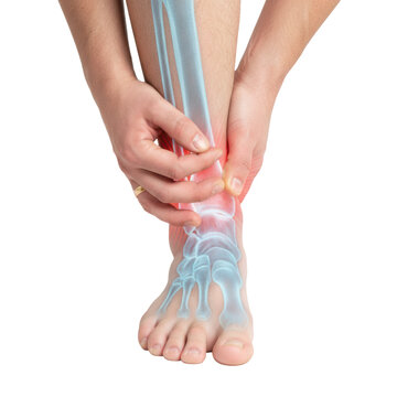 close-up of a bare male leg and gripping hand, showing an ankle injury with a glowing red x-ray overlay of tarsal bones on a white background, medical diagnosis concept