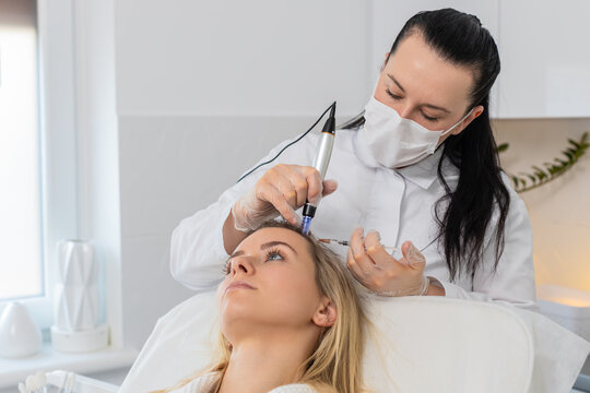 Alopecia. Caucasian girl receives targeted scalp therapy with dermapen and vitamin injection to boost hair growth. Close-up view of cosmetologist performing microneedling and mesotherapy session.