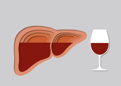 Alcoholic liver damage, conceptual illustration