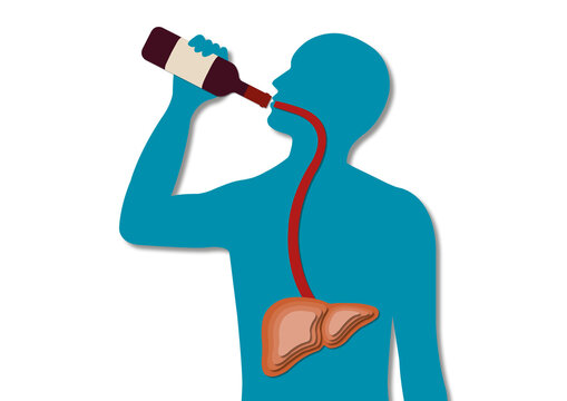 Alcohol consumption, conceptual illustration