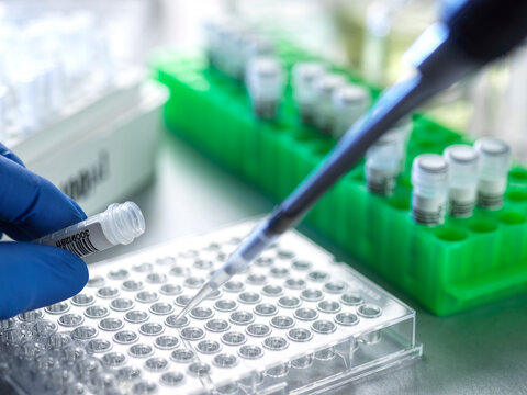 Close-up of a scientist using a pipette in a laboratory with test tubes and trays.