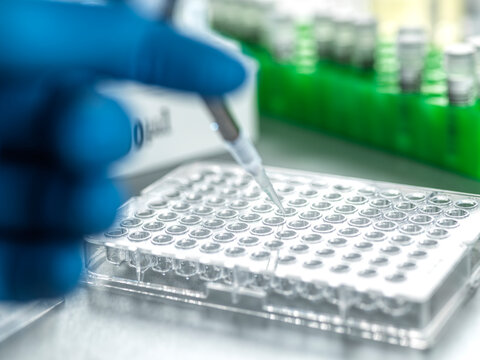 Gloved hand using a pipette to fill wells on a laboratory microplate for scientific analysis.
