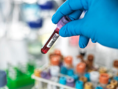 Gloved hand holding a vial of blood over a rack filled with test tubes in a laboratory setting.