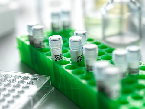 Close-up of laboratory sample tubes in a green holder with soft lighting and blurred background.