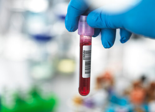 Gloved hand holding a test tube with blood and barcode label in a laboratory setting