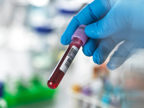 Gloved hand holding a blood sample vial with a barcode in a laboratory setting.