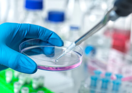 A gloved hand holding a petri dish with a pipette dropping liquid into it in a laboratory.