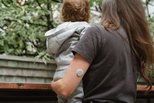 Close-up of a mother from behind holding her curly-haired toddler son, showing a continuous glucose monitor CGM sensor on her arm.