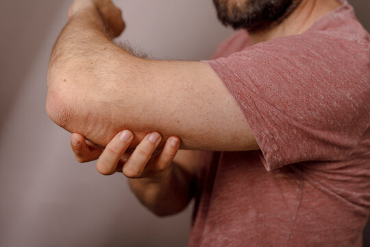 Close up of a man holding his elbow in pain, discomfort and medical condition