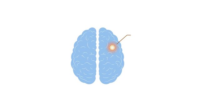 Minimal Human Brain Anatomy Illustration  Highlighted Tumor Location, Medical Diagnostic Concept, Neurological Disease Visualization, Healthcare And Research Graphic.