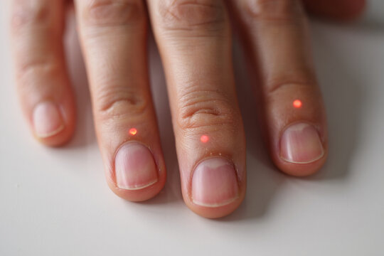 Close up of fingers with red laser dots on skin surface with medical concept