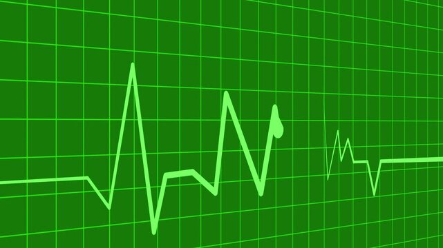 Zigzag line sharp rise and fall suggesting data heart rhythm wave pulse animation