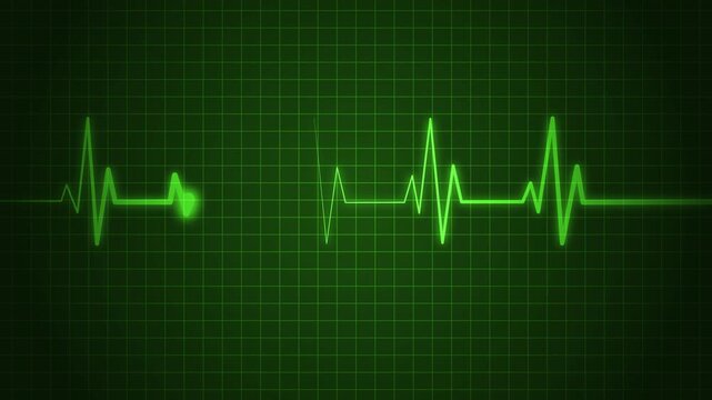 Electrocardiogram line heartbeat rhythm and medical monitor trace animation