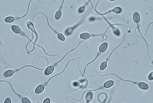 Human spermatozoa observed under microscope