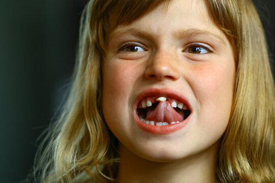 Close-up of a young girl trying to remove a loose front tooth