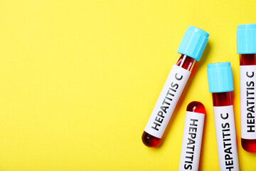 Obraz premium Hepatitis C test. Tubes with blood and labels on yellow background, top view