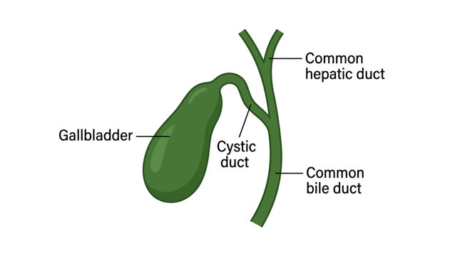 Illustration of a human gallbladder and bile ducts, including the cystic duct, common hepatic duct, and common bile duct, on a white background.