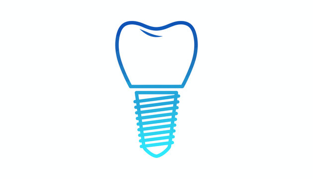 Dental implant, tooth implant, screw, blue, medical, illustration, vector