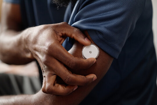 Close up of Black adult adjusting glucose monitor on upper arm, managing diabetes and tracking health data. Ideal for healthcare marketing, chronic care, telehealth, wellness apps