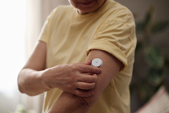 Senior woman applying continuous glucose monitor sensor on upper arm, managing diabetes and tracking health data at home. Useful for medical technology, chronic care, wellness campaigns