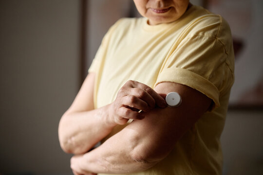 Senior woman applying continuous glucose monitor on upper arm, managing diabetes and tracking health data at home. Close up for medical technology, chronic care, wellness marketing