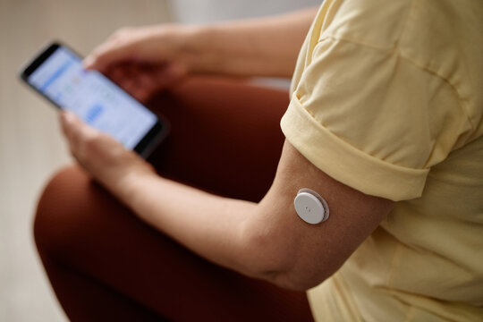 Close up of woman checking smartphone while wearing glucose sensor on arm, monitoring diabetes data. Ideal for healthcare apps, telemedicine, chronic care campaigns