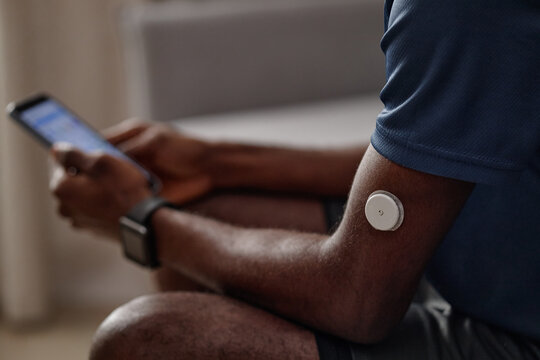 Close up of Black man checking smartphone while wearing glucose monitor on arm, tracking diabetes data and mobile health routine. Ideal for telehealth, chronic care, wellness apps