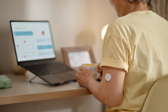 Senior woman monitoring glucose sensor while checking laptop calendar at home, managing diabetes routine. Useful for telehealth, chronic care, patient support marketing