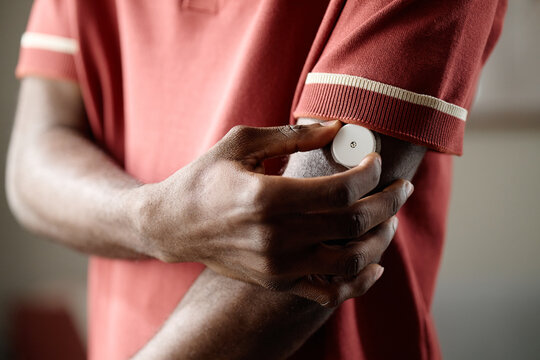 Close up of Black young adult man applying continuous glucose monitor on upper arm, managing diabetes and health tracking. Ideal for medical technology, chronic care, wellness marketing