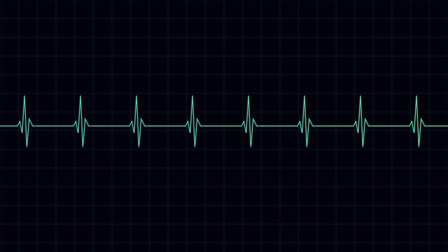 Ekg heartbeat monitor loop: medical digital pulse waveform animation cardiology