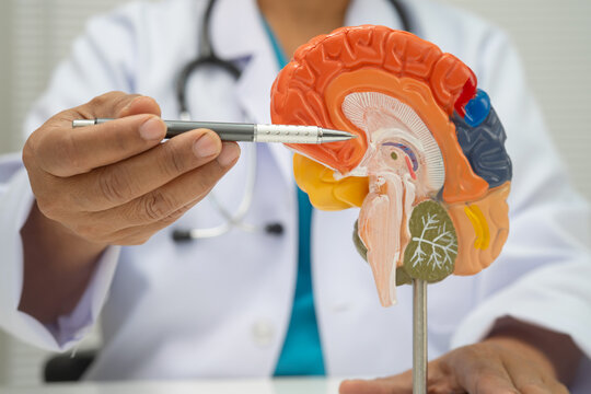 Alzheimer disease, Asian doctor holding brain anatomy model for study diagnosis and treatment in hospital.