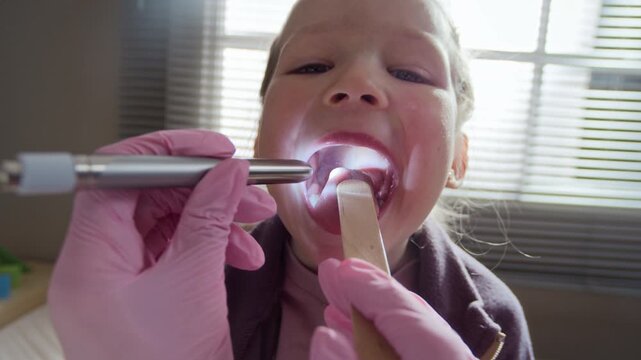 POV of Caucasian child girl opening mouth wide while pediatrician in pink gloves examining throat using tongue depressor and penlight. Footage is ideal for pediatric healthcare services