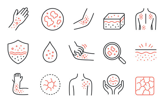 Skin allergy and dermatology line art icons representing symptoms like rash, eczema, psoriasis, dry skin, itching, and inflammation for medical and healthcare concepts