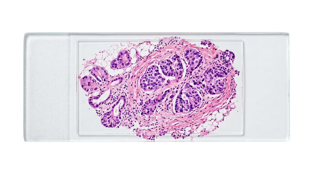 Microscopic view of biological glandular tissue sample on slide