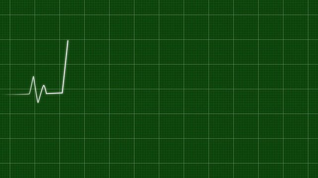 Heart rate monitor electrocardiogram Ekg Or Ecg, white heart beat line animation on green background, loop seamlessly heartbeat in a stressful situation, symbolizing heart activity, 4k