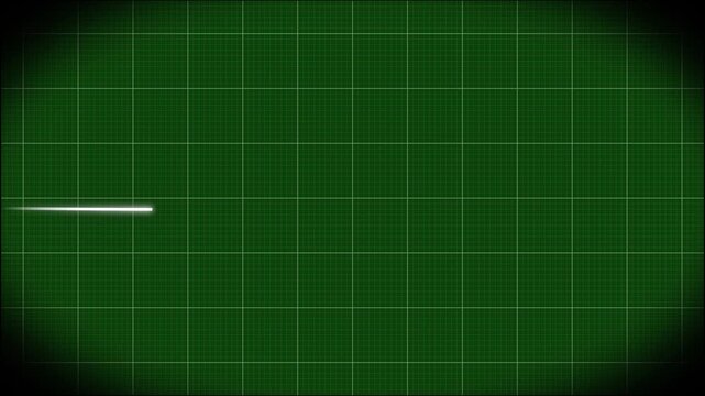Heart rate monitor electrocardiogram Ekg Or Ecg, white heart beat line animation on green background, loop seamlessly heartbeat in a stressful situation, symbolizing heart activity, 4k