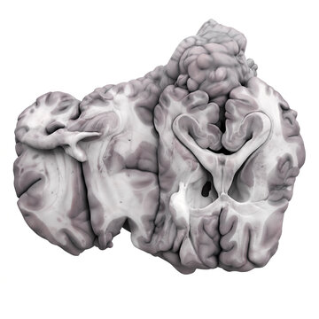 Sheep Brain Anatomy - 3D Coronal and Cross-Sectional Views