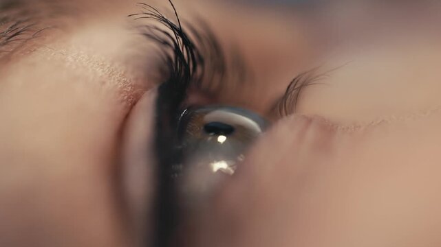 Close-up of a patient's eye during ophthalmic surgery, showcasing the intricate details of the iris and eyelash movements in a clinical medical environment
