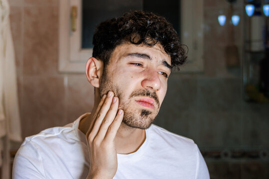 Young man experiencing pain on his face or jaw, needing dental or self care attention