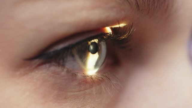 Close-up view of a woman's eye being examined with a slit lamp, showcasing detailed iris and pupil structure under bright light in a clinical setting