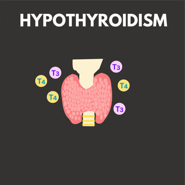 hypothyroidism condition where  it secretes less t3 and t4 concept.eps