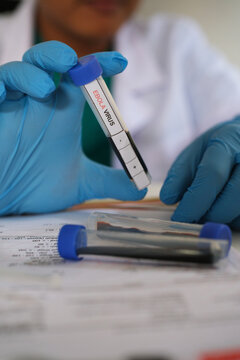 a medical worker or laboratory worker wearing blue gloves and holding EDTA containing a blood sample of an Ebola suspect for examination in the laboratory
